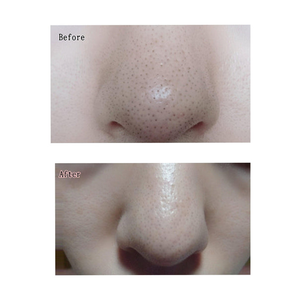 Mizuhashi Hojyudo Itsukano Sekken Enzyme Cleansing Soap Bar 100g